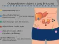 Schemat jamy brzusznej z zaznaczonymi objawami, w tym objaw Jaworskiego w okolicy wyrostka robaczkowego.