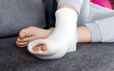 Dziecko z unieruchomioną stopą w białej longecie gipsowej na nodze, odpoczywa na kanapie.
