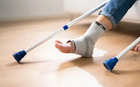 Osoba w ortezie stawu skokowego, opierająca się na kulach, po zabiegu artrodezy stawu skokowego.