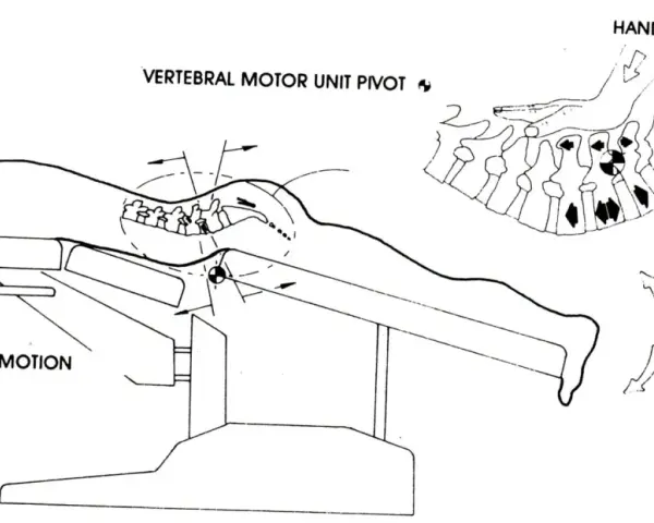 Ilustracja pokazuje technikę manipulacji kręgosłupem, która może pomóc w odpowiedzi na pytanie, czy wypuklina może się cofnąć.